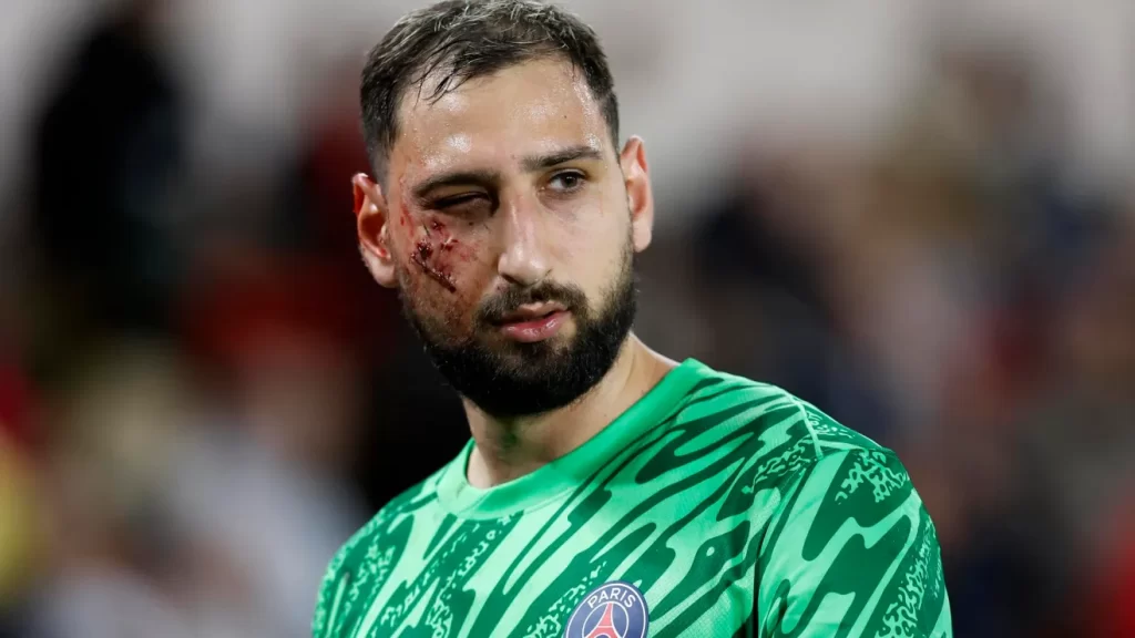 Impactante golpe en el rostro dejó K.O. a Gianluigi Donnarumma