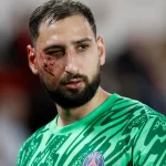 Impactante golpe en el rostro dejó K.O. a Gianluigi Donnarumma